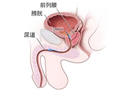 前列腺癌術後之陰莖復健-盧本偉牛逼